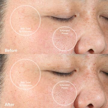 Pmd Clean Sonicglow Facial Cleansing Device - Berry